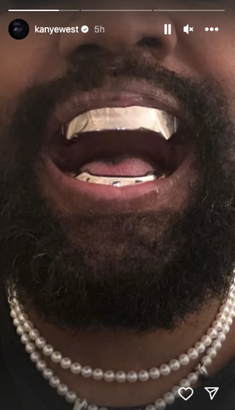Yeezy GR-01 Grillz Silver – HIGHKIOSK
